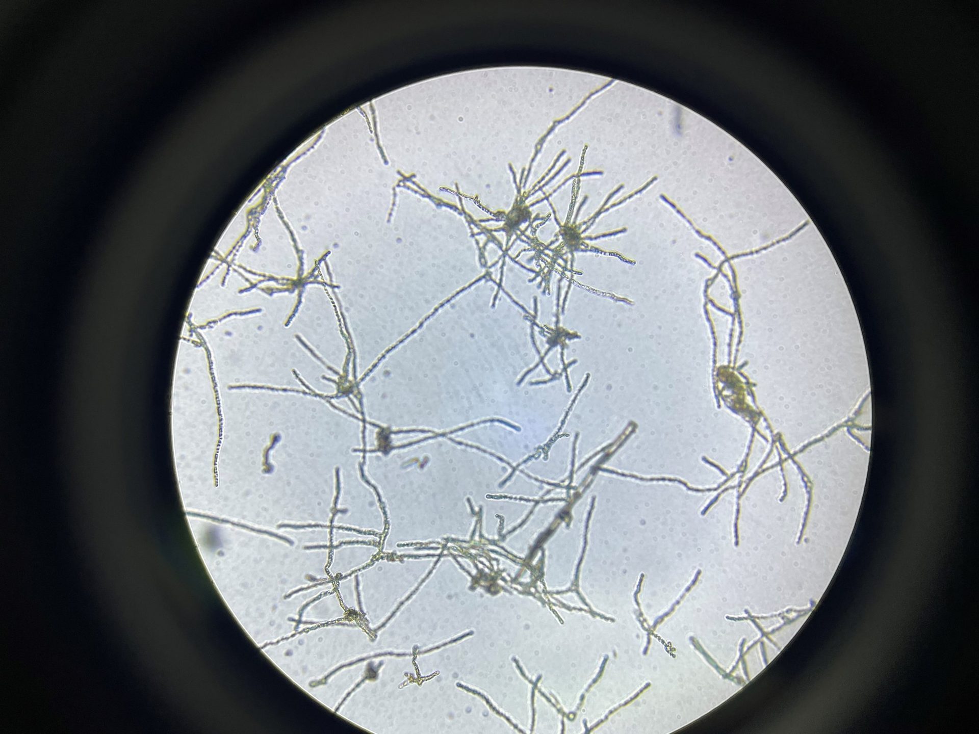 New Moss Strain Development